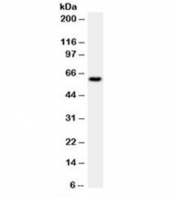Western blot testing of HeLa cell lysate with HSP60 antibody (clone LK1).