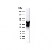 Western blot testing of Hep-2 cell lysate with HSP60 antibody (clone LK2).