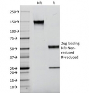 SDS-PAGE Analysis of Purified, BSA-Free Kappa Light Chain Antibody (clone L1C1). Confirmation of Integrity and Purity of the Antibody.