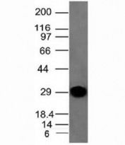 Western blot analysis of human spleen tissue and Kappa antibody (clone KLC264).