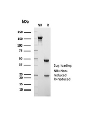 SDS-PAGE analysis of purified, BSA-free KRT8 antibody (clone K8.8) as confirmation of integrity and purity.