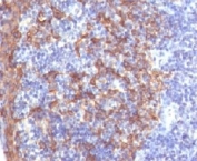 IHC testing of FFPE human prostate with Cytokeratin 14 antibody (clone LL002)