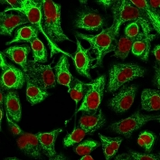 Immunofluorescent staining of human A549 cells with Cytokeratin 14 antibody (clone LL002, green) and Reddot nuclear stain (red).