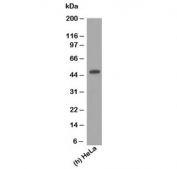 Western blot testing of human samples using Cytokeratin 17 antibody (clone E3).