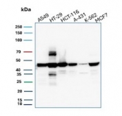 Western blot testing of human tumor cell lysates using Cytokeratin 18 antibody (clone DC10). Predicted molecular weight ~48 kDa.