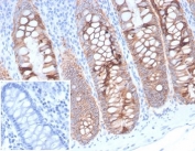 IHC testing of FFPE human colon tissue with EpCAM antibody (clone 323/A3). Inset: PBS used in place of primary Ab (secondary Ab negative control). HIER: boil tissue sections in pH 9 10mM Tris with 1mM EDTA for 20 min and allow to cool before testing.