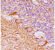 IHC testing of FFPE human cerebellum with Neurofilament antibody (clone NF421).