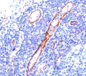 CD31 antibody C31.3 immunohistochemistry tonsil