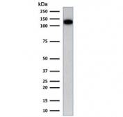 Western blot testing of human Jurkat cell lysate with CD31 antibody (clone C31.1). Expected molecular weight: 83-130 kDa depending on level of glycosylation.