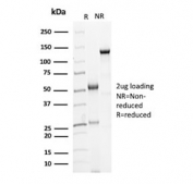 SDS-PAGE analysis of purified, BSA-free ACTH antibody (clone AH26) as confirmation of integrity and purity.