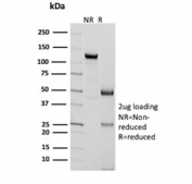 SDS-PAGE analysis of purified, BSA-free ACTH antibody (clone 2F6) as confirmation of integrity and purity.