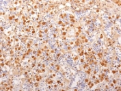 IHC testing of FFPE human pituitary gland with ACTH antibody (clone 2F6)