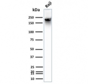 Western blot testing of CD45RB antibody and human Raji lysate. Expected molecular weight: 147-220 kDa depending on glycosylation level.