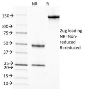 SDS-PAGE Analysis of Purified, BSA-Free RBP Antibody (clone G4E4). Confirmation of Integrity and Purity of the Antibody.