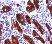 Thyroglobulin antibody 2H11 immunohistochemistry thyroid
