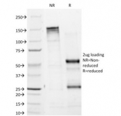 SDS-PAGE Analysis of Purified, BSA-Free Tyrosinase Antibody (clone T311). Confirmation of Integrity and Purity of the Antibody.