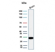 Western blot testing of human brain lysate with PGP9.5 antibody (clone 31A3). Predicted molecular weight ~25 kDa.