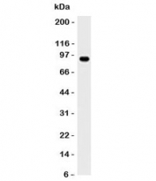 Western blot analysis of Daudi lysate and MALT1 antibody. Expected molecular weight ~92 kDa.