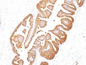 PSA antibody immunohistochemistry clone KLK3/801