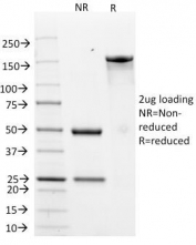 SDS-PAGE analysis of purified, BSA-free HER-2 antibody (clone ERB2/776) as confirmation of integrity and purity.