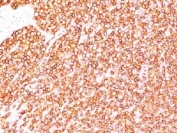 IHC testing of FFPE human tonsil with anti-CD45 antibody (clone SPM570).