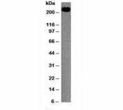 Western blot testing of CD45RB antibody and Daudi lysate. Expected molecular weight: ~147/180-220 kDa (unmodified/glycosylated).