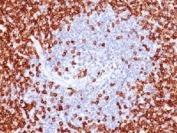 IHC testing of CD45RO antibody and FFPE human tonsil. HIER: boil tissue sections in 10mM citrate buffer, pH 6 for 10-20 min followed by cooling at RT for 20 min.