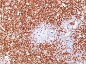 IHC testing of CD45RO antibody cocktail and FFPE human tonsil
