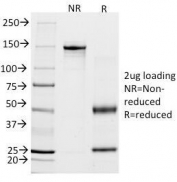 SDS-PAGE Analysis of Purified, BSA-Free Calponin Antibody (clone CALP). Confirmation of Integrity and Purity of the Antibody.