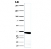 Western blot testing of human endometrium tissue lysate with Calponin antibody. Predicted molecular weight ~34 kDa.