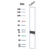 Western blot testing of human colon tissue lysate with Calponin antibody. Predicted molecular weight ~34 kDa.