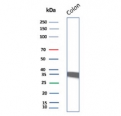 Western blot testing of human colon tissue lysate with Calponin antibody. Predicted molecular weight ~34 kDa.