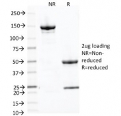 SDS-PAGE analysis of purified, BSA-free Placental Alkaline Phosphatase antibody (clone ALP/870) as confirmation of integrity and purity.