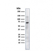 Western blot testing of human JEG-3 cells with Placental Alkaline Phosphatase antibody (clone ALP/870). Predicted molecular weight ~58 kDa but routinely visualized at 60-70 kDa.