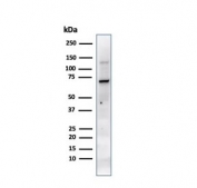 Western blot testing of human JEG-3 cell lysate with Placental Alkaline Phosphatase antibody (clone PL8-F6). Predicted molecular weight ~58 kDa but routinely visualized at 60-70 kDa.