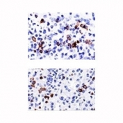 IHC: Formalin-fixed, paraffin-embedded human spleen stained with CD57 antibody (NK-1).