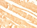 IHC: Formalin-fixed, paraffin-embedded rat heart stained with Glypican-3 antibody (GPC3/863)