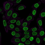 Immunofluorescent staining of permeabilized human HeLa cells with anti-Histone H1 antibody (clone SPM256, green) and Phalloidin (red).