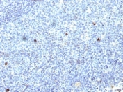 IHC: Formalin-fixed, paraffin-embedded human tonsil stained with HLA-Aw32 / HLA-A25 antibody (SPM418).