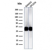 Western blot testing of human Ramos and spleen cell lysate with HLA-DRB1 antibody (clone LN3). Expected molecular weight ~30 kDa.