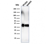 Western blot testing of human spleen and Ramos lysate with HLA-DRB1 antibody (clone SPM288). Predicted molecular weight ~30 kDa.