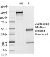 SDS-PAGE Analysis of Purified, BSA-Free ICAM1 Antibody (clone F4-31C2). Confirmation of Integrity and Purity of the Antibody.