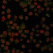 Immunofluorescent staining of PFA-fixed human Raji cells with CF488-conjugated IgA antibody (clone IA761, green) and Reddot nuclear stain (red).