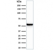 Western blot testing of human HeLa cell lysate with Cytokeratin 7 antibody (clone KRT7/760). Predicted molecular weight ~51 kDa.