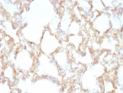 IHC: Formalin-fixed, paraffin-embedded rat lung stained with Keratin 7 antibody (KRT7/1198)