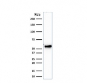 Western blot testing of human HeLa cell lysate with Keratin 7 antibody. Predicted molecular weight ~51 kDa.