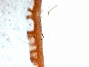 IHC testing of FFPE human skin with Keratin 10 antibody (clone KRT10/844). Required HIER: boil tissue sections in 10mM citrate buffer, pH 6.0, for 10-20 min.