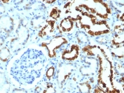 IHC analysis of FFPE human renal cell carcinoma tested with MFGE8 antibody (clone MFG-06).