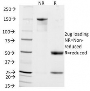 SDS-PAGE Analysis of Purified, BSA-Free CD56 Antibody (clone NCAM1/795). Confirmation of Integrity and Purity of the Antibody.