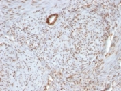 IHC: Formalin-fixed, paraffin-embedded human uterus stained with Nucleolin antibody.